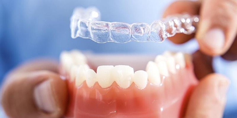 Traitement Invisalign